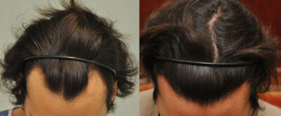 MT NoShavekettoskep1 - Sikos Klinika