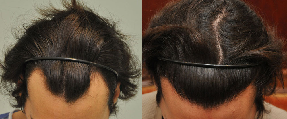 MT NoShavekettoskep1 - Sikos Klinika