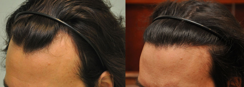 MT NoShavekettoskep3 - Sikos Klinika