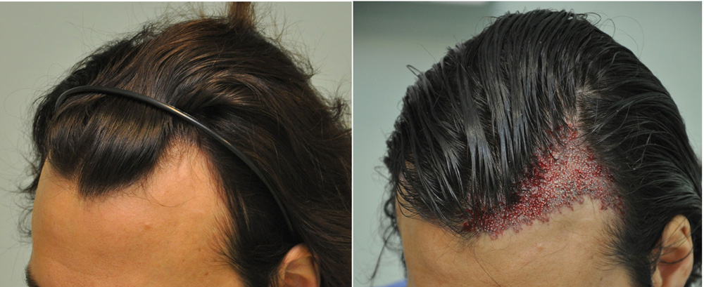 MT NoShavekettoskep33 - Sikos Klinika