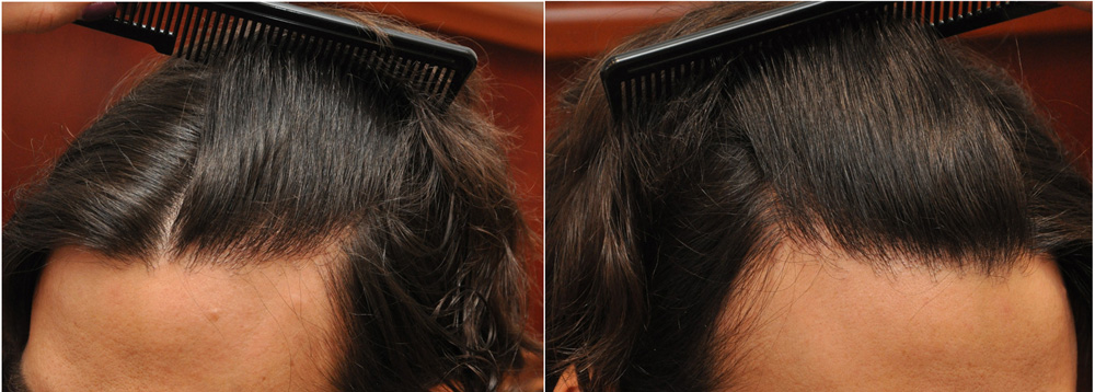 MT NoShavekettoskepuu - Sikos Klinika