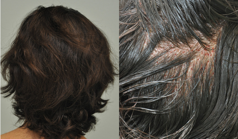 MTdonor uu - Sikos Klinika