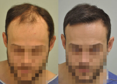 KJB1kettoskep - Sikos Klinika