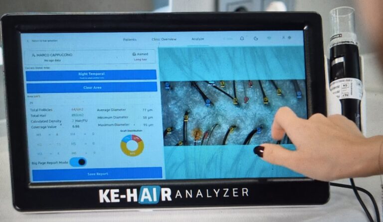 KE HAir analyzer kep